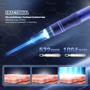 350P siêu ngắn xung thời gian picosecond <span class=keywords><strong>Laser</strong></span> Giá Máy 532 755nm 1064nm 1320nm Nd Yag Pico <span class=keywords><strong>Laser</strong></span> loại bỏ hình xăm thiết bị - Product Image 4