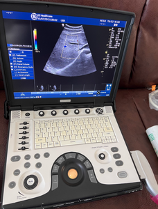 Fourniture et réparation de la machine à ultrasons portable LOGIQ e LOGIQE ,LOGIQ.e - Product Image 4