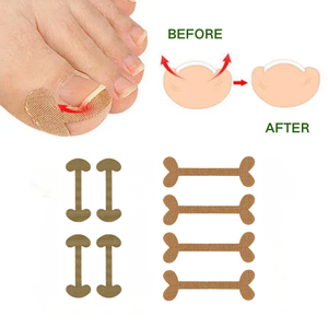Parches Correctores de Uñas Encarnadas de Algodón Elástico Hipoalergénico Color Piel Sin Pegamento, Herramientas de Pedicura, Caja, Directo de Fábrica - Product Image 4