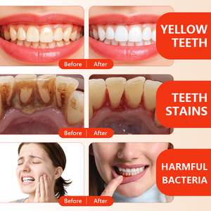 Bán buôn keepup SP-4 Probiotic làm trắng kem đánh răng hữu cơ 120G để sử dụng nhà-Chống khoang hơi thở tươi & làm mới bằng miệng - Product Image 3