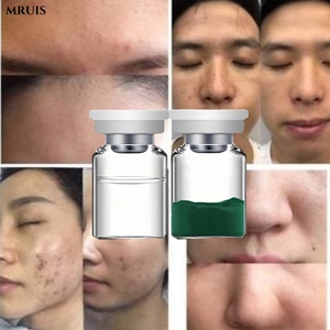 Commercio all'ingrosso Anti invecchiamento rassodante siero Spa acqua dolce alghe Kit di Resurfacing della pelle verde Peel iperpigmentazione forma liquida di alghe - Product Image 3