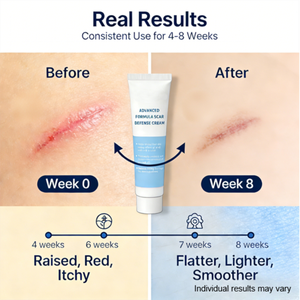 Crema Reparadora de Cicatrices Postoperatorias <span class=keywords><strong>con</strong></span> Alantoína y Tecnología Multi-Target para la Curación de Heridas Quirúrgicas Después de la Retirada de Suturas 20g - Product Image 6