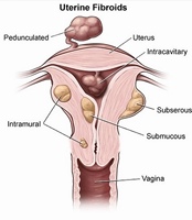 Suppositoire vaginal naturel à base de plantes pour éliminer les odeurs, soins féminins, perle de détox Yoni