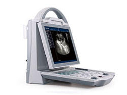 Escáner de Ultrasonido Veterinario Portátil KX5600V con Pantalla LED de 10.4 Pulgadas y Sonda Microconvexa de 6.5MHz para Animales Pequeños - Product Image 4