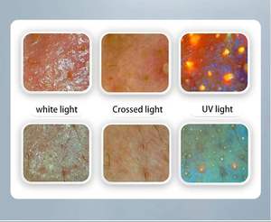 Nouveau modèle de technologie d'IA, analyseur de peau 3D à technologie d'IA, prix, <span class=keywords><strong>machine</strong></span> de <span class=keywords><strong>test</strong></span> de la peau, analyseur de peau du visage pour la maison et le salon - Product Image 5