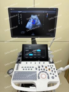 Système d'échographie sur chariot Sonoscape P50 Elite et échographie Doppler couleur pour usage vétérinaire avec service à long terme - Product Image 1
