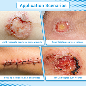 Apósito de <span class=keywords><strong>alginato</strong></span> de silicona Bluenjoy súper absorbente para el cuidado de heridas, dispositivo médico desinfectante EOS, certificado CE, 3 años de vida útil - Product Image 6