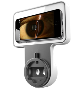 Dispositivo de Imagenología Móvil con Lámpara de Hendidura para Oftalmología y Optometría - Product Image 6