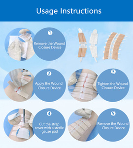 Tiras Médicas Redutoras de Cicatrizes Konlida, Dispositivo de Fechamento de Feridas Adesivo, Tiras de Fechamento de Pele Sem Sutura, Certificado ISO13485 - Product Image 6