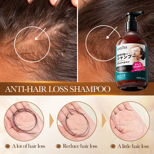 Shampoo anti-chute de cheveux SADOER, nettoie et élimine les pellicules avec une mousse douce <span class=keywords><strong>qui</strong></span> n'irrite pas <span class=keywords><strong>le</strong></span> <span class=keywords><strong>cuir</strong></span> <span class=keywords><strong>chevelu</strong></span> - Product Image 4