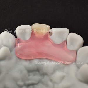Pont PFM personnalisable haute résistance studio dentaire dents en métal fusionné en porcelaine certifié ISO laboratoire fabriqué en Chine - Product Image 6