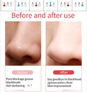 Estação Facial Profissional 6 em 1 SP-122: Limpeza, Lifting e Terapia Térmica para Serviços de Salão Aprimorados - Product Image 6