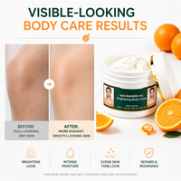 Crème hydratante éclaircissante pour le corps à la niacinamide et à la vitamine C, soin anti-gerçures pour les coudes, lotion éclaircissante pour les taches sombres de la peau du corps