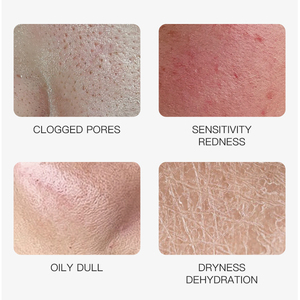 KORMESIC Mascarilla Facial de Belleza PARA EL Cuidado DE LA Piel, 25ml, Venta Al por Mayor, Granada, Té, Árbol, Albahaca, Lavanda, Oliva, Barro Volcánico, Arándano, Mascarilla Facial - Product Image 3