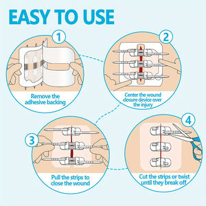 Bandes adhésives chirurgicales Zip Stitch Sutures Butterfly pour la réparation des lésions et la fermeture d'urgence des plaies - Product Image 4