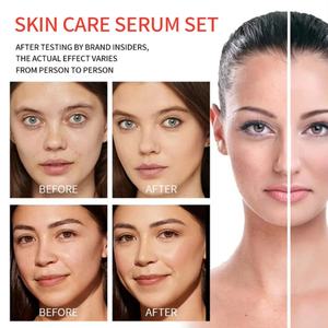 Suero Profesional Antienvejecimiento con Vitamina C para el Cuidado de la Piel, Tratamiento Iluminador para Rostro y Cuerpo para Proveedores Mayoristas - Product Image 5