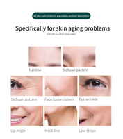 Dispositivo de Belleza Profesional para Lifting Facial sin Agujas, Bio Microcorriente, Activador Celular Facial