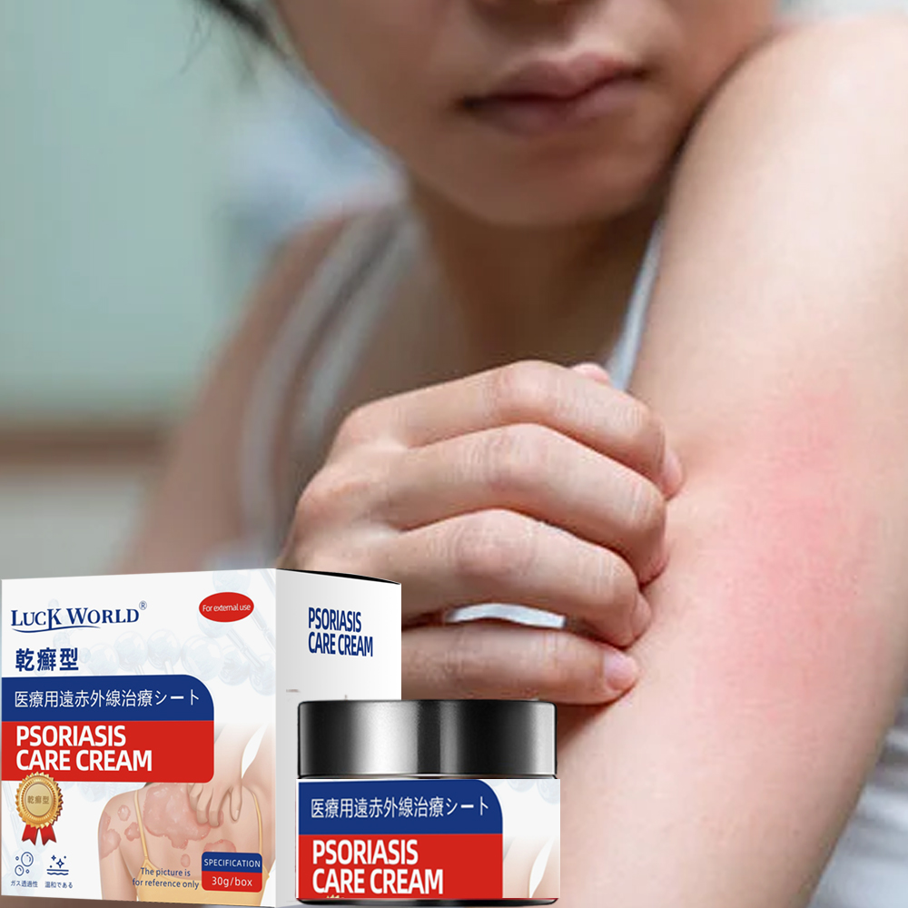 Organic Natural Psoriasis Traditional Chinese Medicine Ointment for Adults Skin Care Eco-Friendly Soothing 30g
