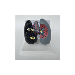 Modelo de Comparación de Ciencias Médicas: Pulmones Humanos Fumadores, Patología, Modelo de Enfermedad, Modelo de Enfermedad Orgánica, Modelo Antidrogas - Product Image 1