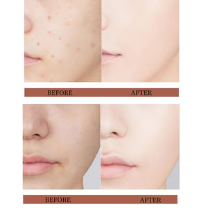 Suero Facial Blanqueador 5 en 1 de Marca Privada OEM con Ácido Hialurónico, Vitamina C, E, Colágeno y Nicotinamida - Product Image 4