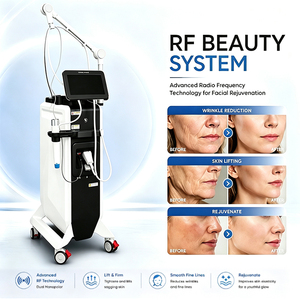 Máquina Profesional de Rejuvenecimiento Facial y Estiramiento de la Piel, Doble Frecuencia 6.78MHz + 2MHz, Máquina de Contorno Facial para Salón de Belleza - Product Image 3
