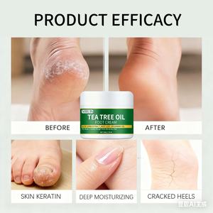 Crème pour les pieds au thé vert en gros, 50 g, réparation des peaux mortes, élimination des peaux mortes, hydratante, <span class=keywords><strong>anti</strong></span>-pelage, hydratante pour les mains et les pieds - Product Image 4