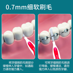 แปรงซอกฟันพร้อมขนแปรงไนลอนนุ่มพิเศษ ลวดสแตนเลสสำหรับดูแลช่องปาก - Product Image 4