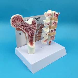 Modèle d'anatomie de l'ostéoporose du fémur humain PVC jambe os coupe transversale tranche vertébrale pathologique vertèbres lombaires pour la science médicale - Product Image 3