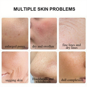 Máquina de Belleza Facial de Alta Calidad con Dispositivo de Burbujas de Oxígeno, Hidrodermoabrasión con Diamante, Oxígeno Facial e Hidratación - Product Image 5