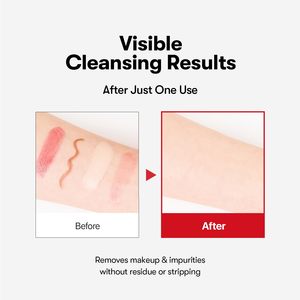 Olio Detergente all'Acido Azelaico, Texture Leggera e Acquosa, Senza Profumo, Struccante per Pelli Sensibili e Acneiche - Product Image 3