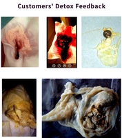 Chinaherbs Original Toutes Naturelles Perles Yoni Suppositoires Nettoyantes Vaginaux Fertilité Originales