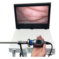 Pantalla de endoscopio HD Sistema de endoscopio médico todo en uno de 19 pulgadas para endoscopio rígido