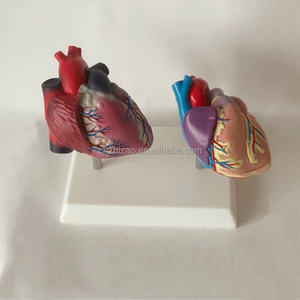 Maniquí de PVC avanzado de tamaño real para falla cardíaca patológica humana, con láminas arteriales vasculares y corazón anatómico saludable - Product Image 4