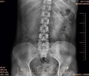 17*17 pouces Gos filaire numérique X Ray détecteur de défauts à écran plat équipement de radiologie et accessoire pour machine à rayons X humaine - Product Image 3