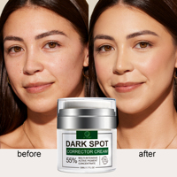 Crème éclaircissante pour le visage à marque privée, éliminateur de taches brunes, crème blanchissante puissante, éliminateur de taches de rousseur, correcteur