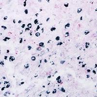 Kit de Tinción de Melanina de Alta Calidad Solarbio (Método de Sulfato de Ferro) para Investigación Científica