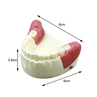 Modelo de Práctica para Extracción de Dientes Impactados, Modelo Oral Simulado con Diente Impactado Removible y Base Desmontable