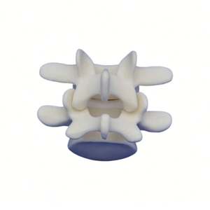 <span class=keywords><strong>Vertebra</strong></span> lombare <span class=keywords><strong>L4</strong></span> e L5 in schiuma solida KyrenMed modello osseo per la formazione in officina di ortopedia avvitamento e placcatura - Product Image 4