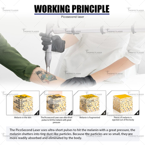 Máy xóa hình xăm bằng <span class=keywords><strong>laser</strong></span> pico thế hệ mới <span class=keywords><strong>2025</strong></span>, công suất 2000mj, 4 bước sóng 3000W: 532nm, 755nm, 1064nm, 1320nm, Nd:YAG, công nghệ Q-switched - Product Image 6