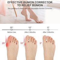 Set Korektor Bunion Besar Ortopedi Abu-abu yang Dapat Disesuaikan, Anti Selip, Bahan Tekstil, untuk Wanita/Pria, Satu Ukuran, Logo Dapat Disesuaikan, 2 X Pelurus Jari Kaki