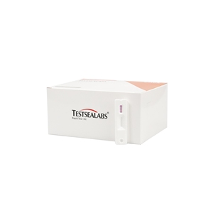 Prueba de Detección de Anticuerpos contra el VIH <span class=keywords><strong>1</strong></span>/2 de Testsealabs, Prueba de Diagnóstico Rápido Oral para el VIH <span class=keywords><strong>1</strong></span>/2, Kit de Prueba de Antígeno para Uso Doméstico - Product Image 2