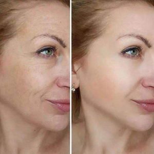 Offre Spéciale – <span class=keywords><strong>Baume</strong></span> Multi-Usages au Calcium Non Gras Cemenrete – Stick Raffermissant Portable au Calcium Améliorant <span class=keywords><strong>l</strong></span>'Élasticité et le Volume – <span class=keywords><strong>Baume</strong></span> Multi-Usages au Calcium - Product Image 4