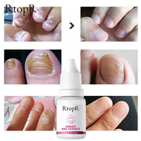 Rtopr 10ml Huile Essentielle de Gingembre pour Ongles des Mains et des Pieds, Sérum Adoucissant, Réparateur, Fortifiant, Anti-Fongique et Anti-Griseauté