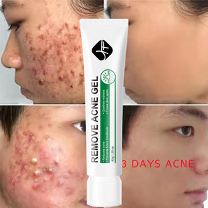 Mới đến loại bỏ mụn trứng cá mặt huyết thanh axit salicylic Gel loại bỏ mụn trứng cá nổi mụn mờ dần đốm Gel Kem - Product Image 5