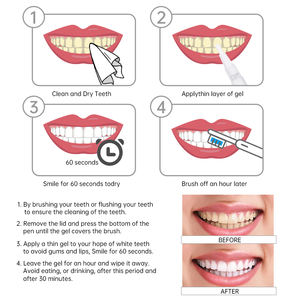 Baixo Preço 16% Hp Gels Opalescência Ouro Dentes <span class=keywords><strong>Whitening</strong></span> Gel 925 Prata - Product Image 6