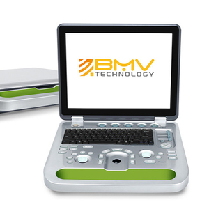 Máquina <span class=keywords><strong>Veterinaria</strong></span> BPU50, Ecógrafo Portátil Veterinario Económico, Utilizado para Escanear la Gestación de Animales - Product Image 1