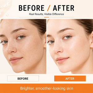 Nettoyant Visage Bio à la Papaye et Vitamine C de Haute Qualité pour l'Élimination des Points Noirs, le Resserrement des Pores, l'Hydratation et le Blanchiment - Product Image 2