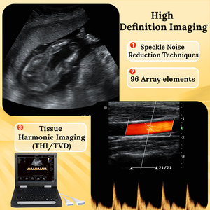 CU5 Portable Color Doppler Ultrasound Dual Probe <strong>Interface</strong> for Human &amp; Veterinary Use Clinic &amp; Farm Ultrasound - Product Image 5