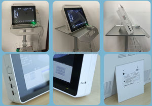 <span class=keywords><strong>2025</strong></span> Nieuws Lage Prijs Draagbare Laptop 15 Inch Echografie <span class=keywords><strong>Machine</strong></span> Sun-800S - Product Image 3