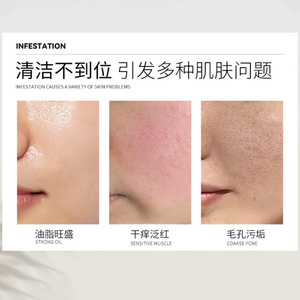 Limpiador Facial de Azufre Baiwen 100ml, Limpieza Profunda, Control de Grasa, Suave para Todo Tipo de Piel - Product Image 2